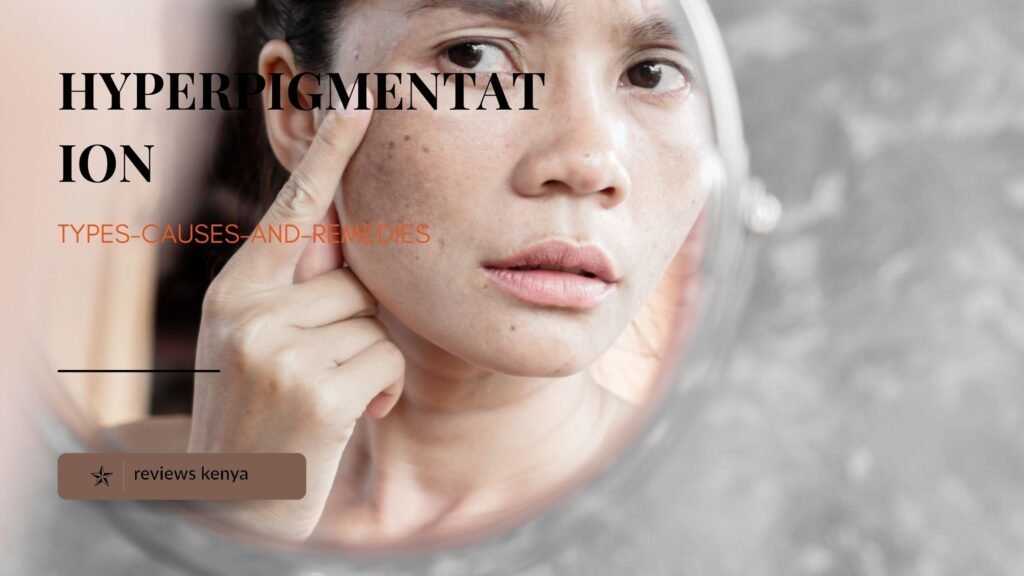 hyperpigmentation types-causes-and-remedies